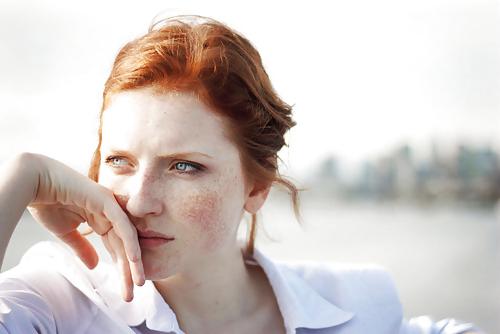 25P Freckles....
