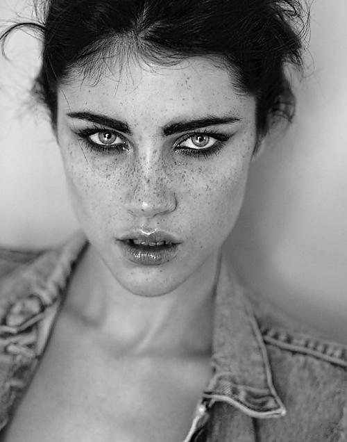 25P Freckles....