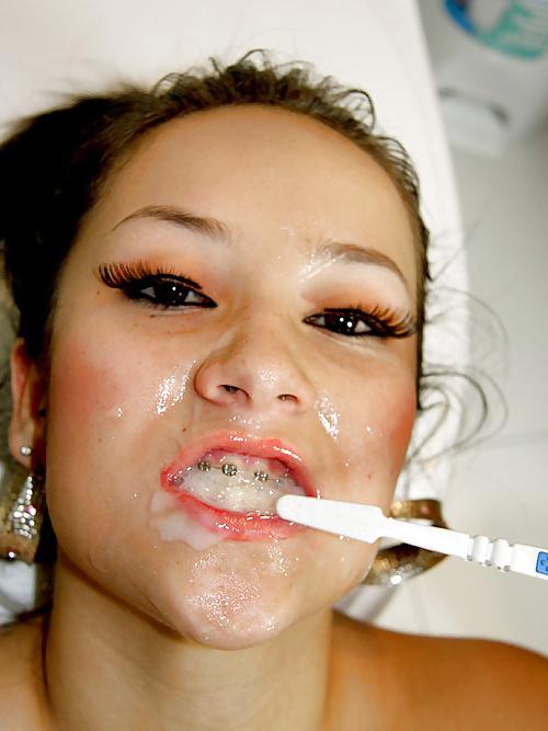21P Oral hygien
