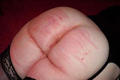 25P Spanked asses (Some my own handiwork)