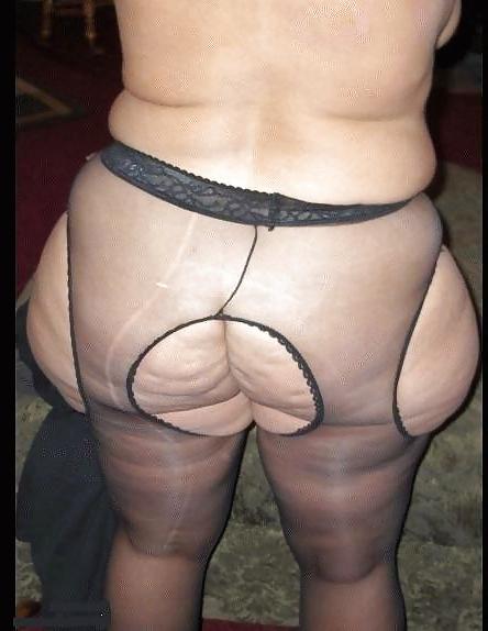 25P Thick, White, and Cellulite 45