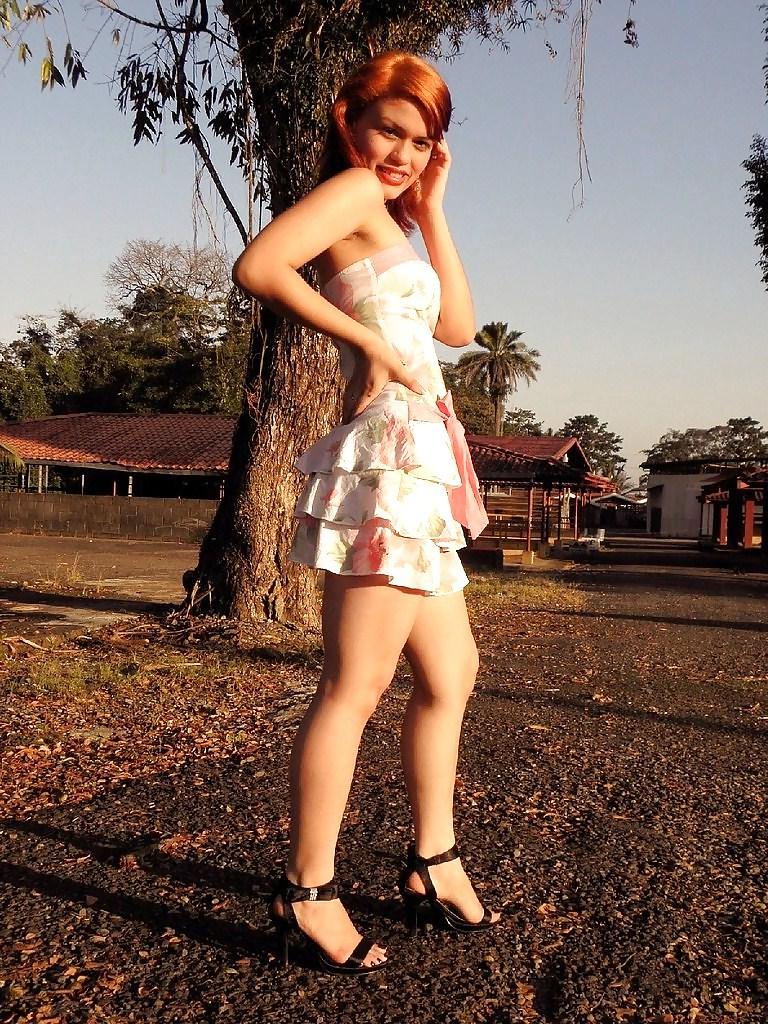 9P Hotlegs-summer dress