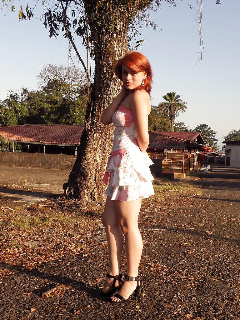 9P Hotlegs-summer dress