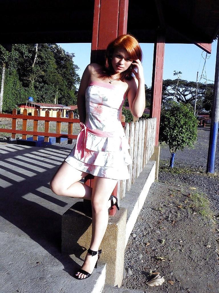 9P Hotlegs-summer dress