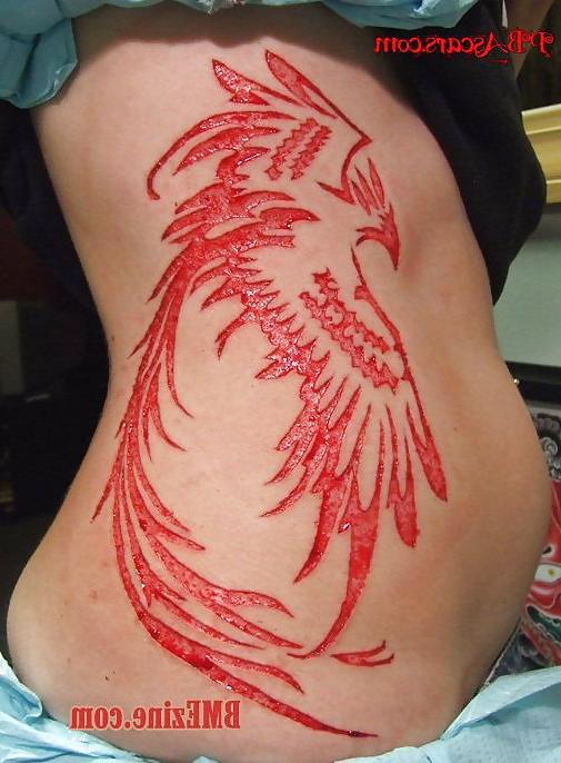 22P Teens and  Scarification -  Body Modification