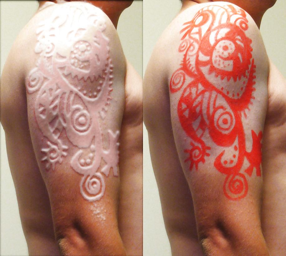 22P Teens and  Scarification -  Body Modification