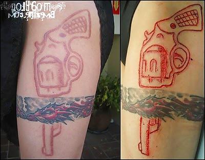 22P Teens and  Scarification -  Body Modification