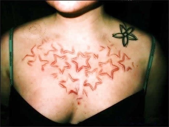 22P Teens and  Scarification -  Body Modification