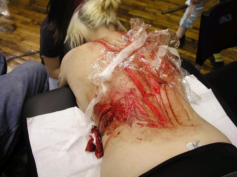 22P Teens and  Scarification -  Body Modification