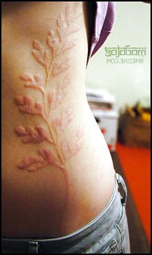 22P Teens and  Scarification -  Body Modification