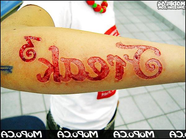 22P Teens and  Scarification -  Body Modification
