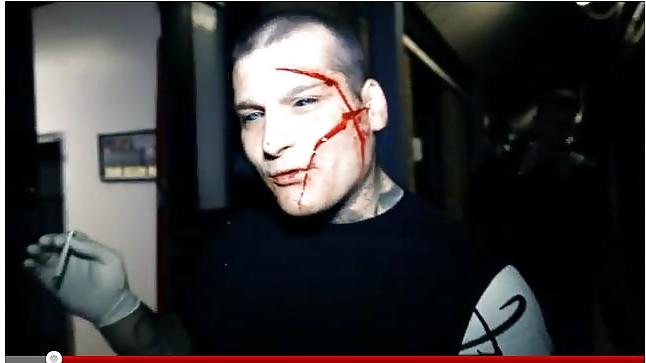 22P Teens and  Scarification -  Body Modification