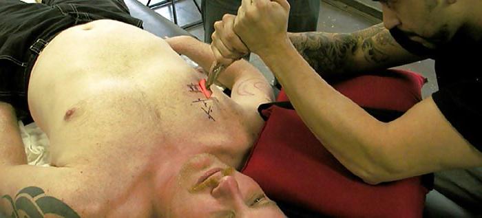 22P Teens and  Scarification -  Body Modification