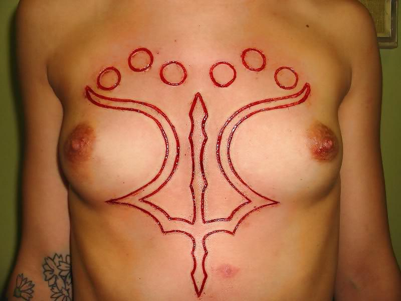 22P Teens and  Scarification -  Body Modification