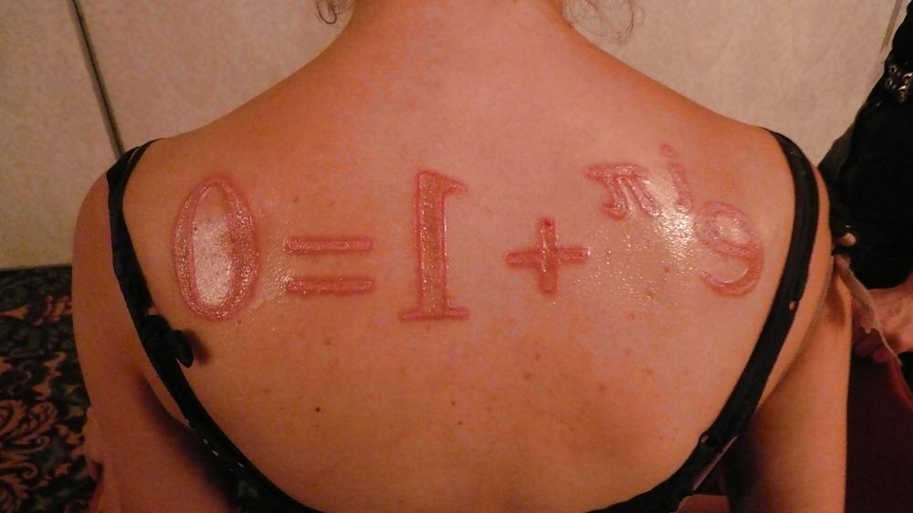 22P Teens and  Scarification -  Body Modification