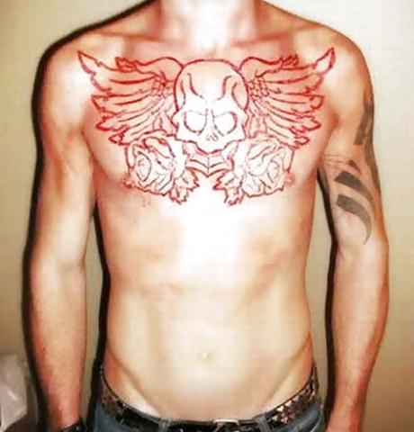 22P Teens and  Scarification -  Body Modification