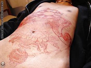 22P Teens and  Scarification -  Body Modification