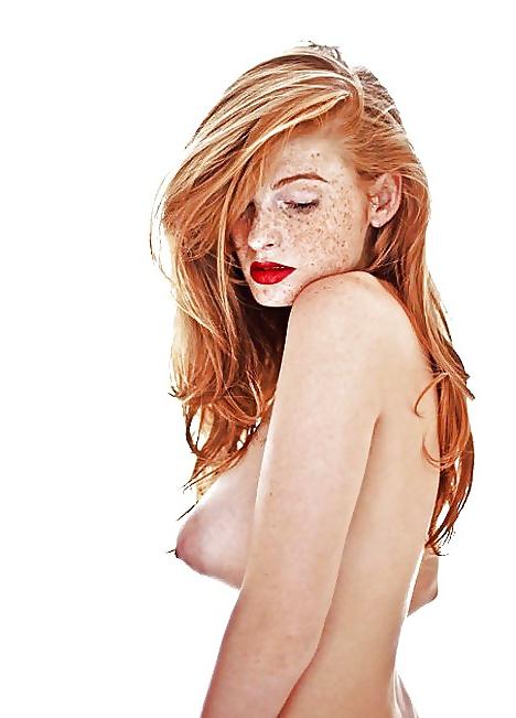25P Freckled