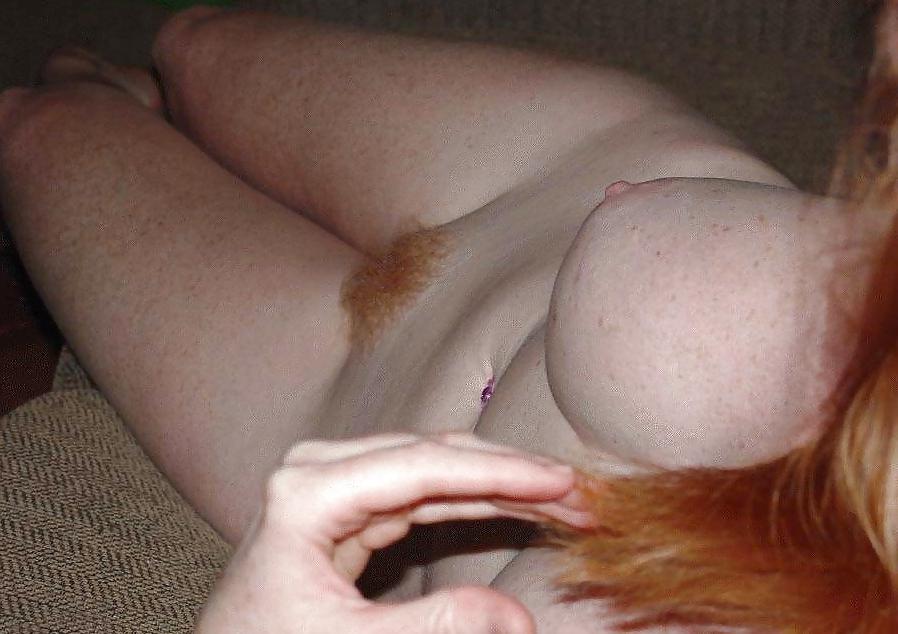 11P Hotties with Spotties - Freckles