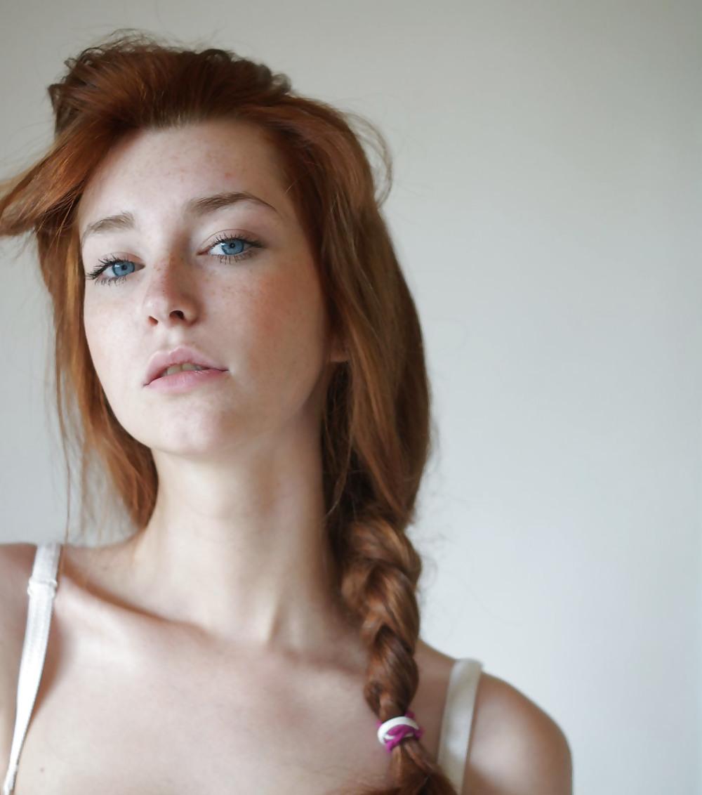 11P Hotties with Spotties - Freckles