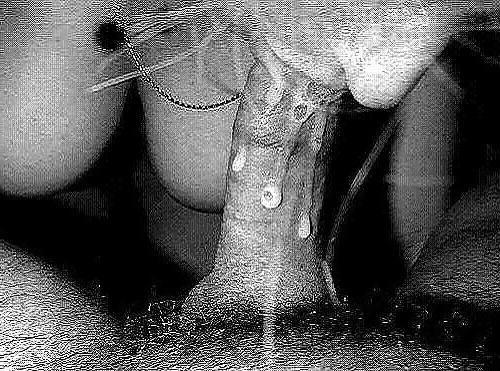 21P Oral