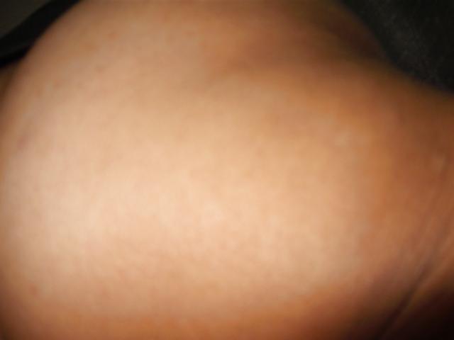 24P Fotos oral