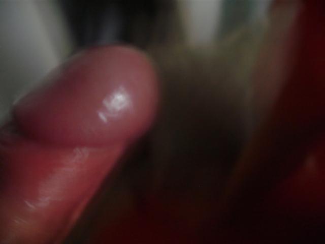 24P Fotos oral