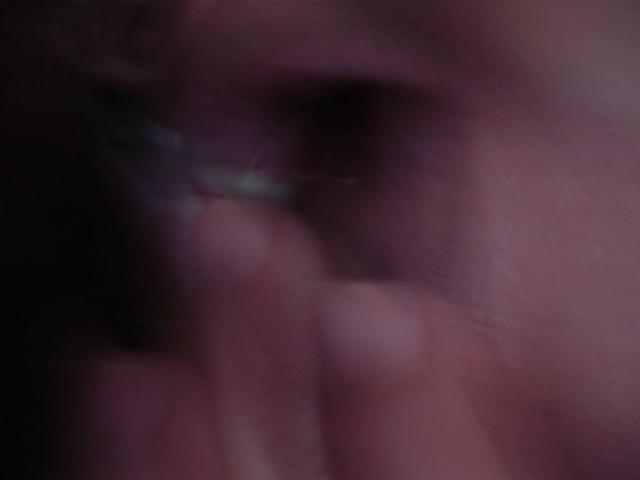 24P Fotos oral