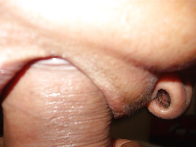 24P Fotos oral