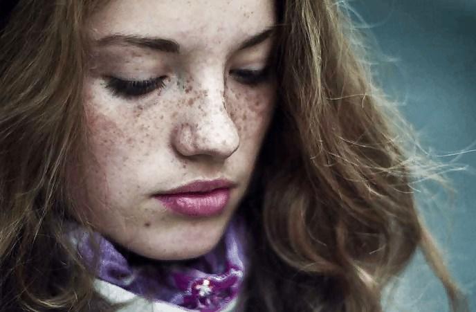 25P S.e.X.y Freckles #2