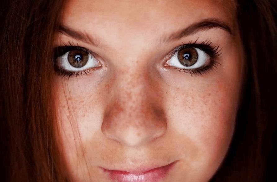 25P S.e.X.y Freckles #2