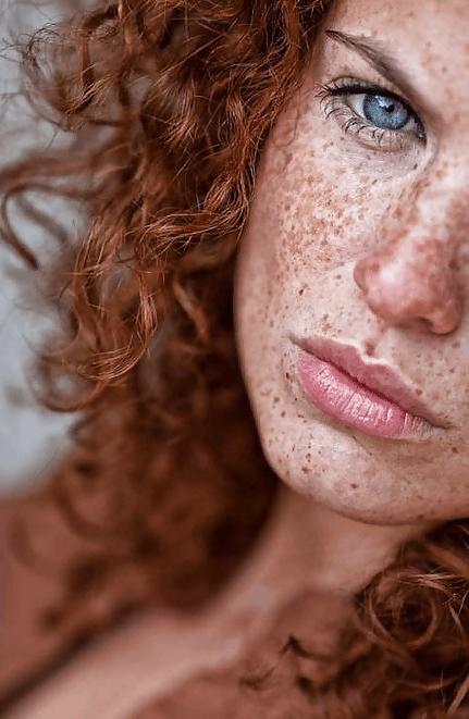 25P S.e.X.y Freckles #2
