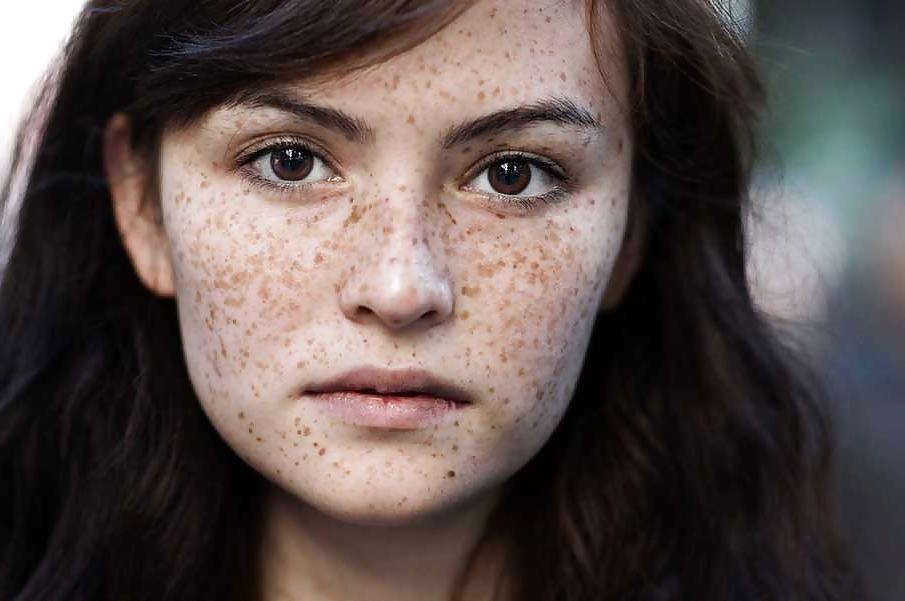 16P Cute freckled faces