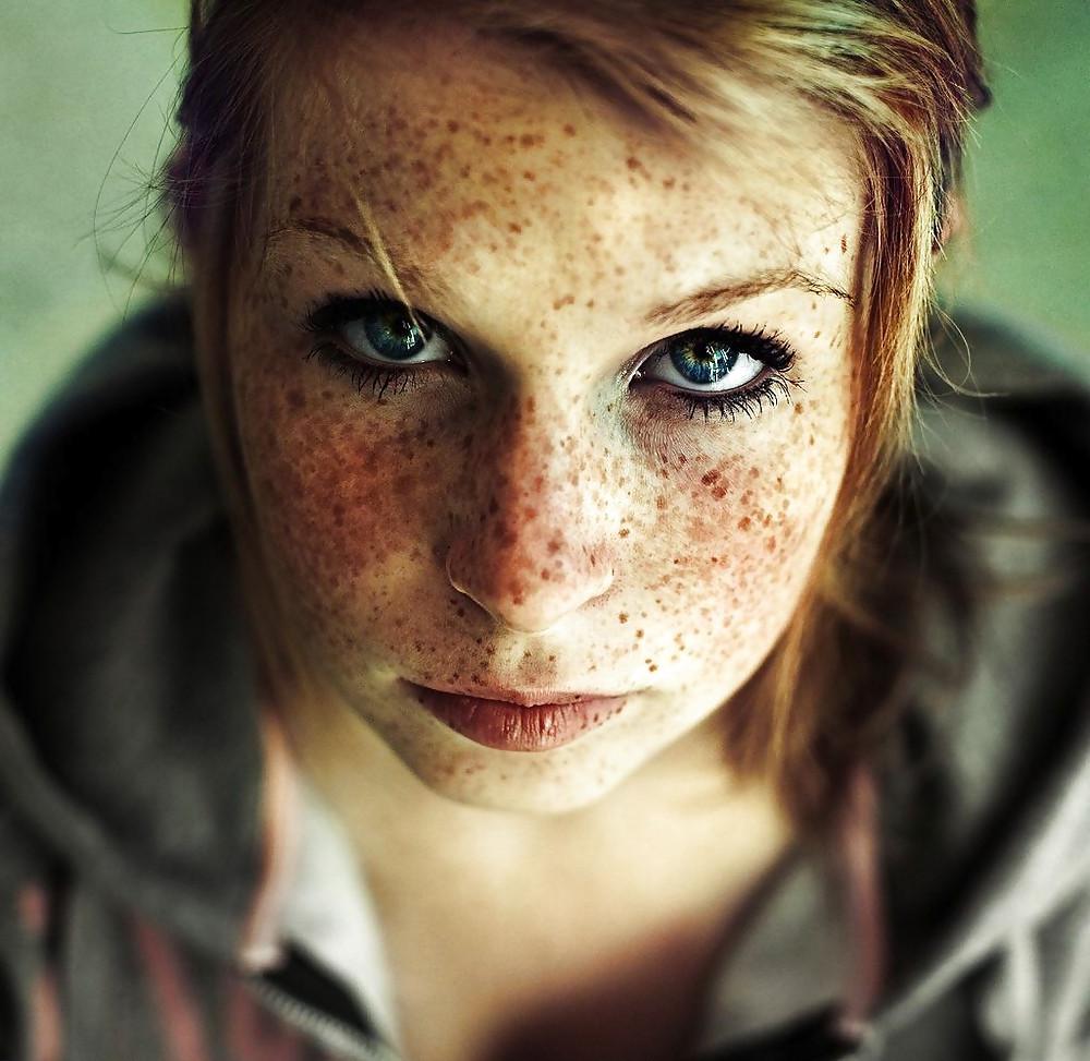 16P Cute freckled faces