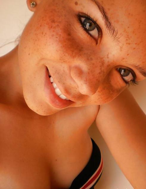 25P S.e.X.y Freckles