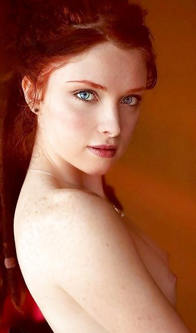 25P S.e.X.y Freckles