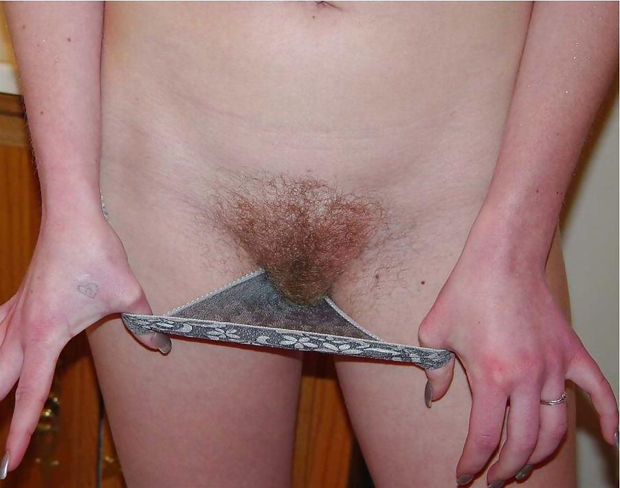 25P From the Moshe Files: The Hairy Beaver Returns