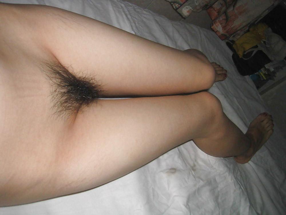 25P From the Moshe Files: The Hairy Beaver Returns