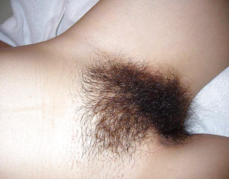 25P From the Moshe Files: The Hairy Beaver Returns