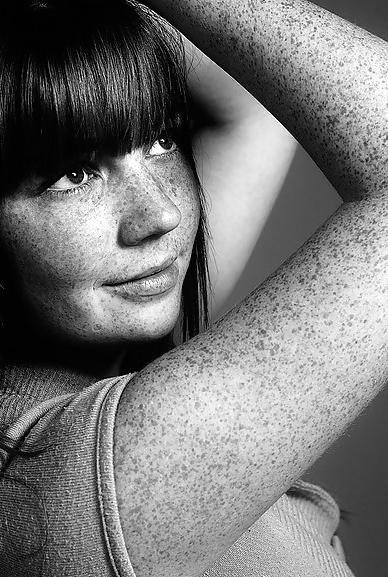 25P S.e.X.y Freckles #3