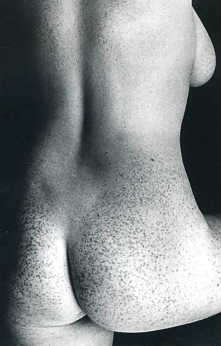 25P S.e.X.y Freckles #3