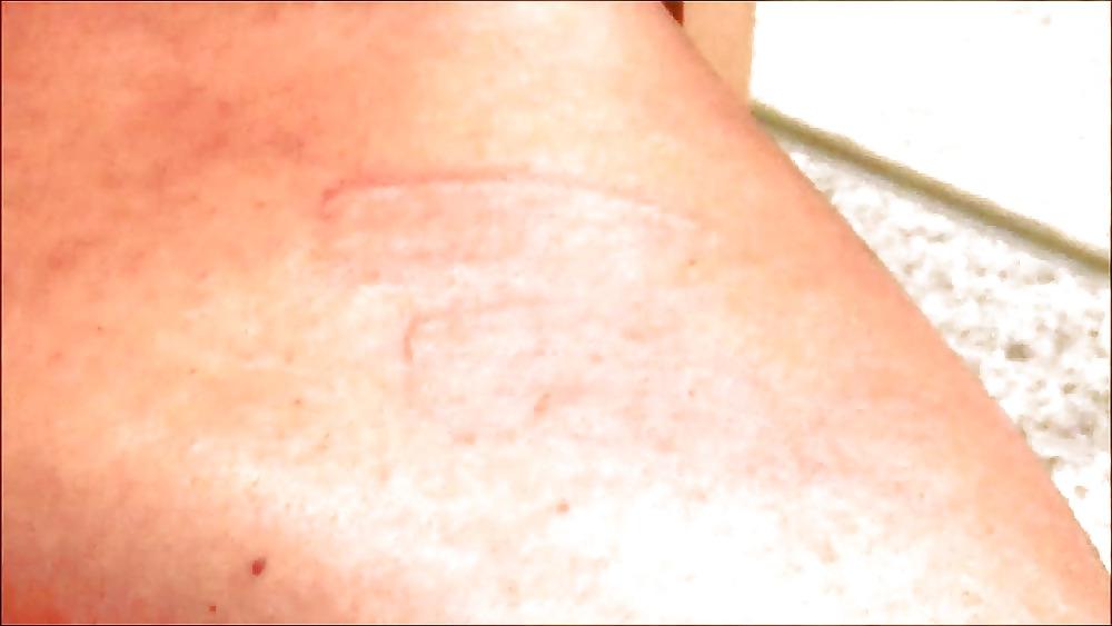 19P In pain .to sex