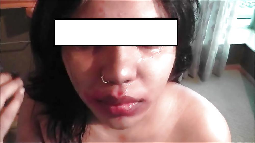 19P In pain .to sex