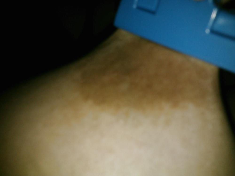 17P TITS PAIN #1