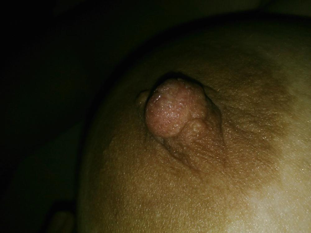 17P TITS PAIN #1