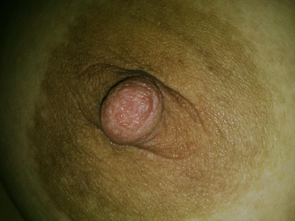 17P TITS PAIN #1