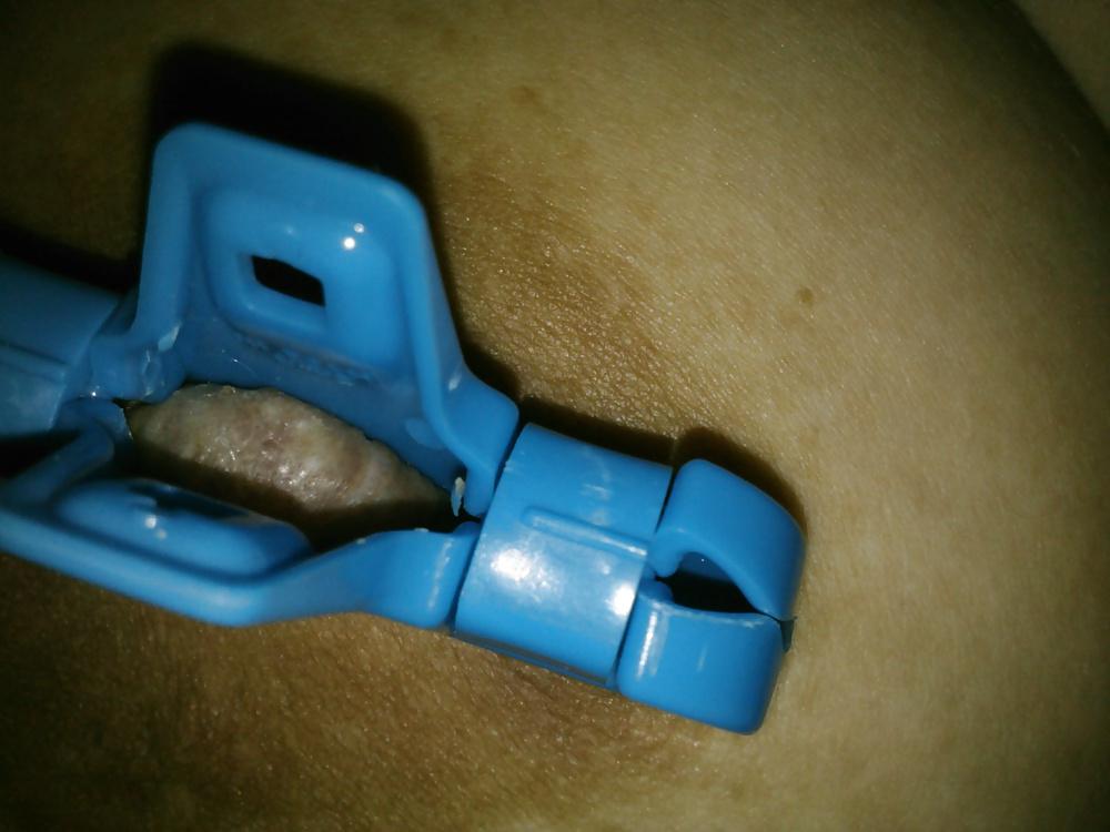17P TITS PAIN #1