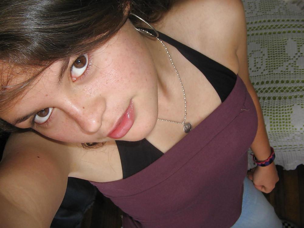 15P Freckled Teens