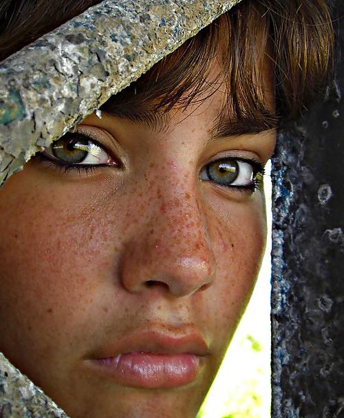 15P Freckled Teens