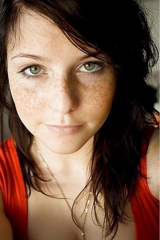 15P Freckled Teens